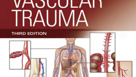 ریچز واسکولار تروما (Rich's Vascular Trauma)