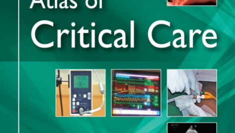اطلس مراقبت های ویژه Atlas of Critical Care
