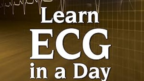ECG را در یک روز بیاموزید
