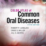 اطلس رنگ بیماری های شایع دهان